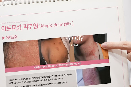 생기한의원 아토피 관련 피부 질환 상담 전 체크리스트 정리